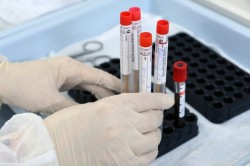 Более 18 тысяч проб крови на антитела к COVID-19 взяли в Кашире с начала пандемии