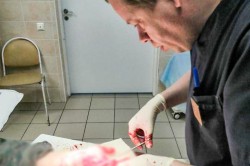 Каширские врачи спасли руку мужчины, перерезавшего кисть забором из профлиста