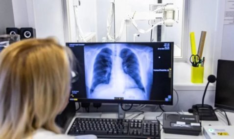 В Каширской больнице заработал новый цифровой рентген