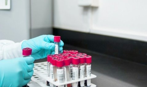 Более 30 человек с подтвержденным COVID-19 проходят лечение в Каширской ЦРБ