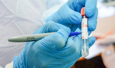 В Ожерелье выявлено самое большое по округу количество инфицированных COVID-19