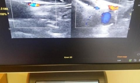 Новый аппарат УЗИ пополнил диагностическое отделение Каширской ЦРБ