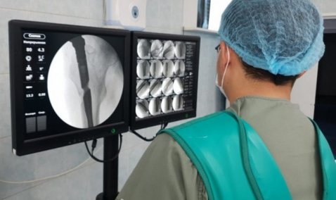 В Каширской ЦРБ рассказали о применении эффективных методов лечения сложных переломов