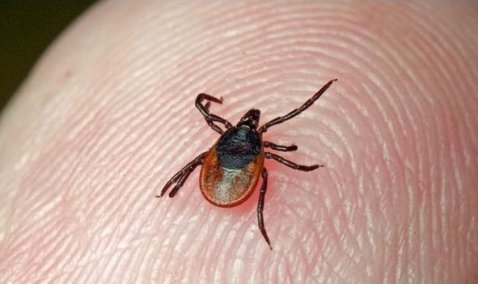 Более ста каширян этой весной обратились за помощью после укуса клеща