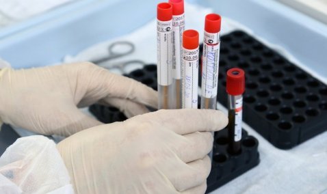 Более 18 тысяч проб крови на антитела к COVID-19 взяли в Кашире с начала пандемии