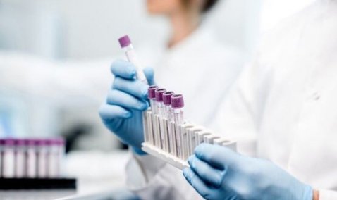 В реанимации Каширской ЦРБ лежит мужчина с коронавирусом?