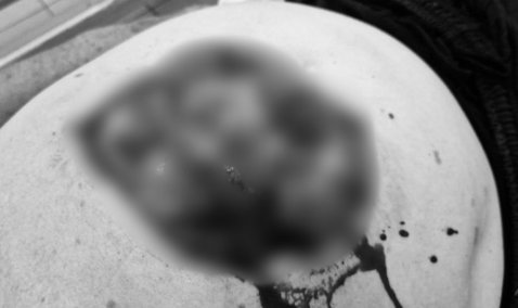 В Кашире пожилой мужчина с распоротым животом самостоятельно пришел в больницу