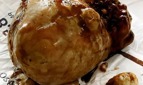 В Кашире врачи удалили девушке огромную доброкачественную опухоль матки