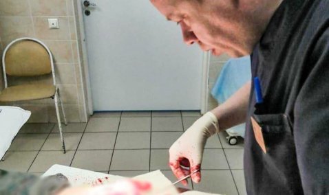 Каширские врачи спасли руку мужчины, перерезавшего кисть забором из профлиста