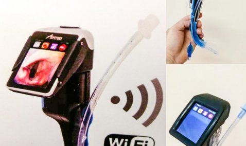 Современный видеоларингоскоп для осмотра и проведения операций появился в анестезиолого-реанимационном отделении Каширской ЦРБ