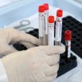 Более 18 тысяч проб крови на антитела к COVID-19 взяли в Кашире с начала пандемии